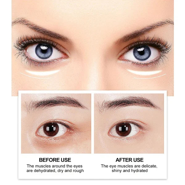 AGM™️ Anti-Wrinkle Eye Cream